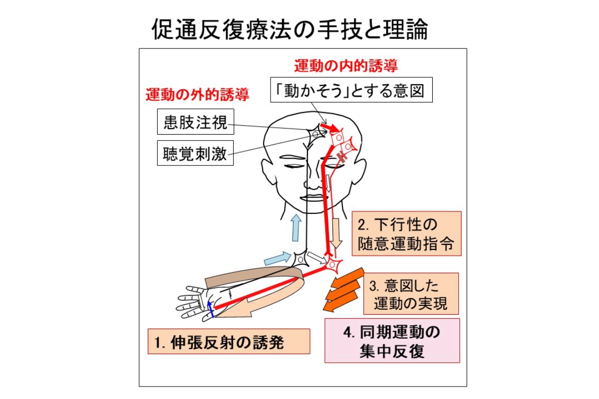 手技
